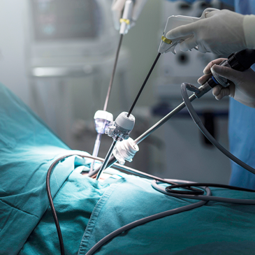 The Benefits of Robotic Surgery
